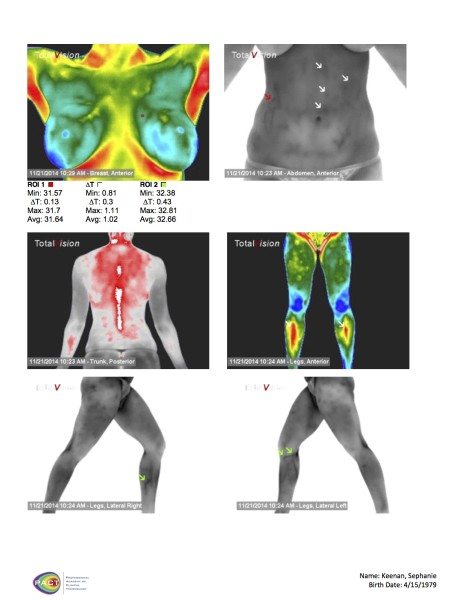 charleston thermography florida